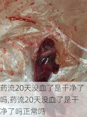 药流20天没血了是干净了吗,药流20天没血了是干净了吗正常吗