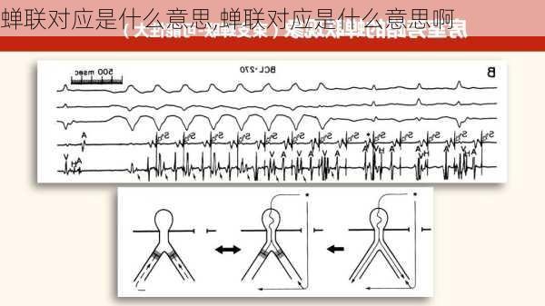 蝉联对应是什么意思,蝉联对应是什么意思啊