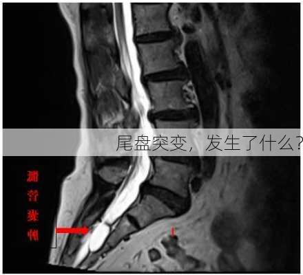 尾盘突变，发生了什么？